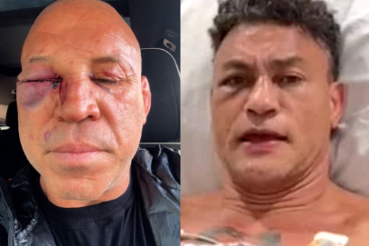 Estado de Saúde de Wanderlei Silva Após a Luta com Popó
