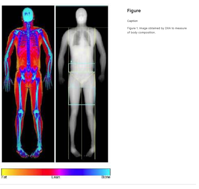 A composição corporal no Diabetes Tipo 1: qual método funciona melhor?